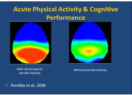 Brain image after excercise